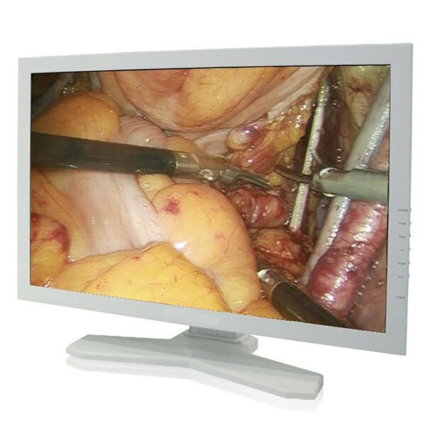 ENDOSCOPY SURGICAL MONITOR - Image 3