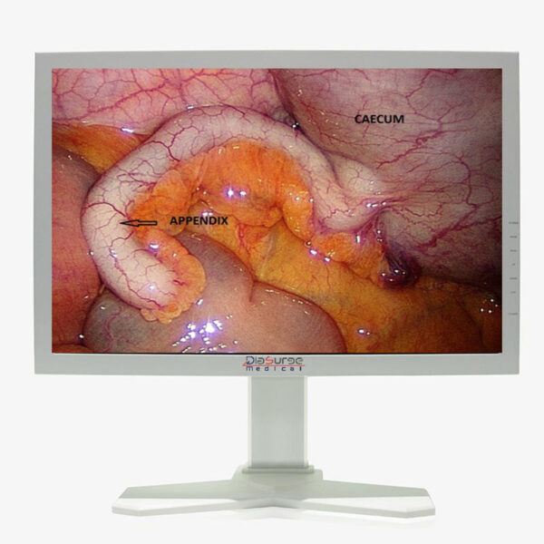 ENDOSCOPY SURGICAL MONITOR